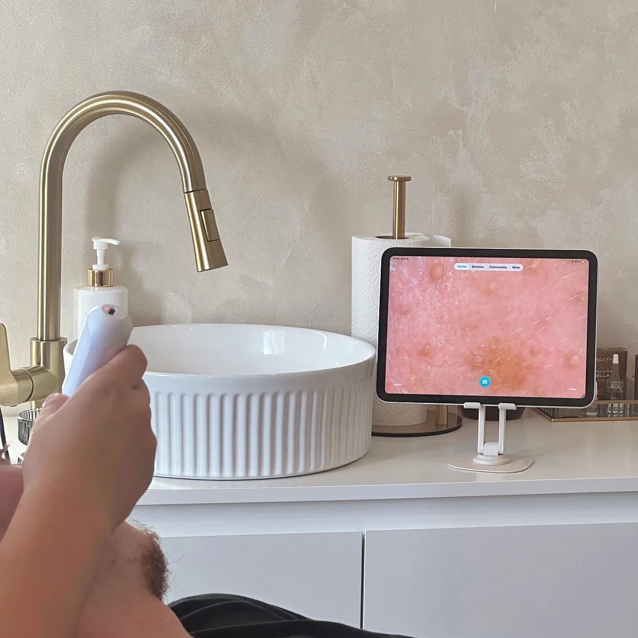 Diagnostická kamera v ruce a na tabletu zvětšený snímek pleti